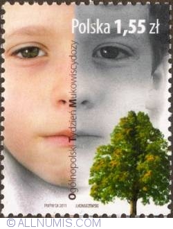 Image #1 of 1,55 Zloty 2011 - Child's face and tree (Week of Cystic fibrosis)